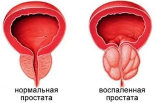 Prostamid : sastav samo prirodni sastojci.